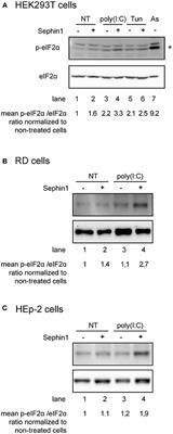 Evaluation of the Antiviral Activity of Sephin1 Treatment and Its Consequences on eIF2α Phosphorylation in Response to Viral Infections